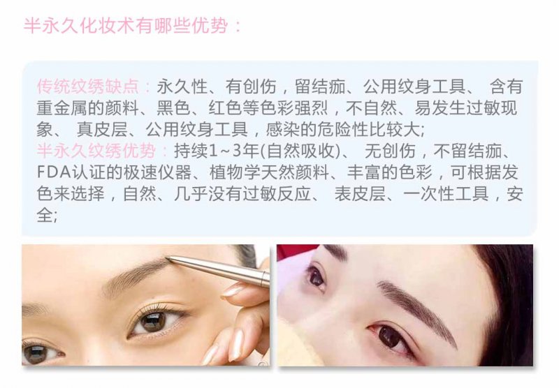 案例图片