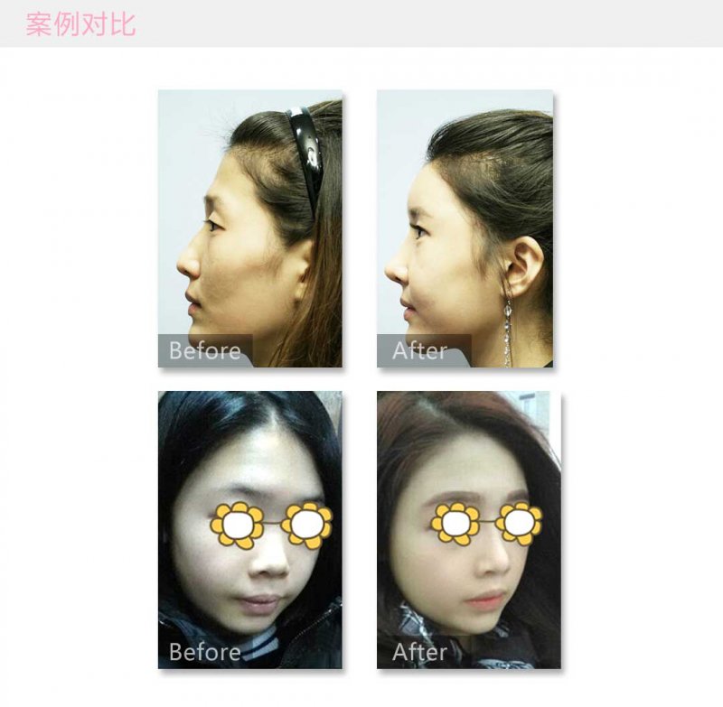 案例图片