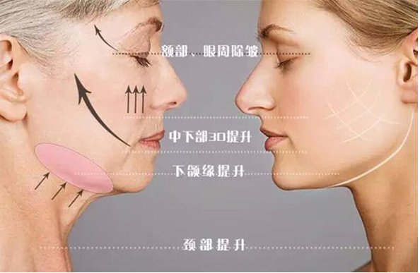 https://img.yiyiaimei.com/Editor/2016-04-06/5704e0dd027d3.jpg