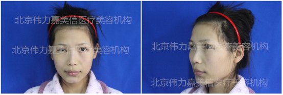 案例图片