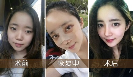 案例图片