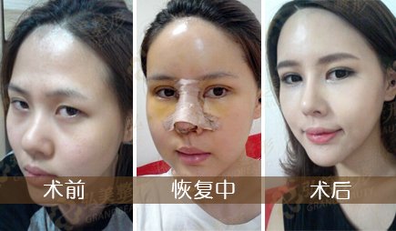 案例图片