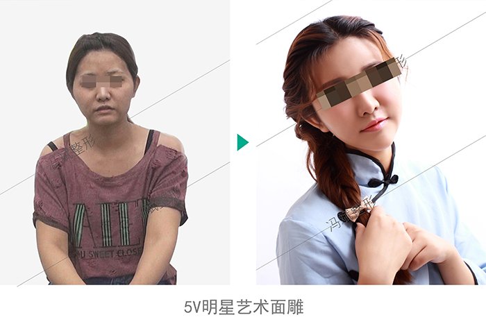 https://img.yiyiaimei.com/Editor/2016-04-19/5715e807ee31b.jpg