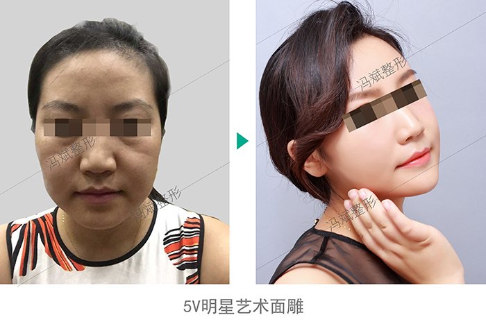https://img.yiyiaimei.com/Editor/2016-04-19/5715e8084195f.jpg
