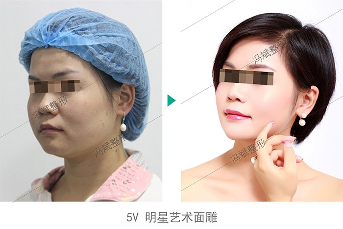 https://img.yiyiaimei.com/Editor/2016-04-19/5715e8086dd94.jpg