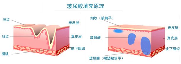 案例图片