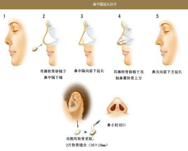 案例图片