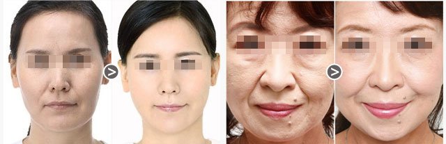https://img.yiyiaimei.com/Editor/2016-04-25/571d8bc69a7e8.jpg