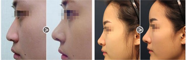 https://img.yiyiaimei.com/Editor/2016-04-25/571db07bdf54b.jpg