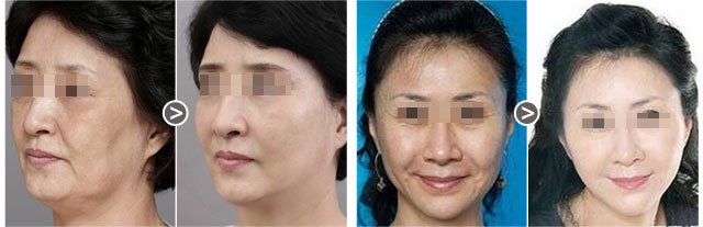 https://img.yiyiaimei.com/Editor/2016-04-25/571dbe4bb1800.jpg