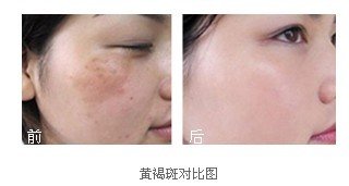案例图片