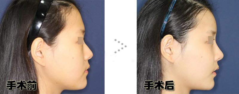 https://img.yiyiaimei.com/Editor/2016-05-26/5746b66e55324.jpg