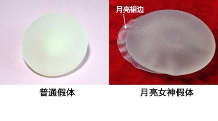 案例图片