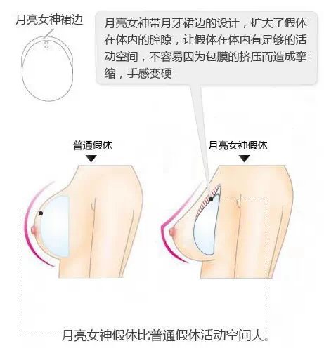 案例图片
