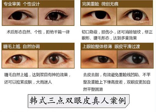 案例图片