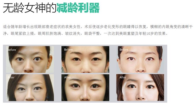 案例图片