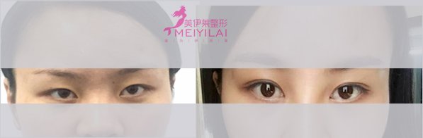 https://img.yiyiaimei.com/Editor/2016-11-08/582199a34a7ad.jpg