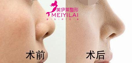 https://img.yiyiaimei.com/Editor/2016-11-08/5821a02caf07c.jpg