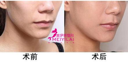 https://img.yiyiaimei.com/Editor/2016-11-08/5821a3c097ac7.jpg