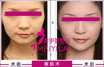 https://img.yiyiaimei.com/Editor/2016-11-08/5821aa13e072a.jpg
