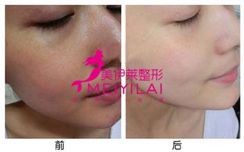 https://img.yiyiaimei.com/Editor/2016-11-08/5821ae0375e45.jpg