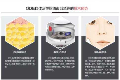 案例图片