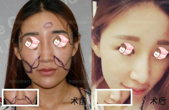 案例图片
