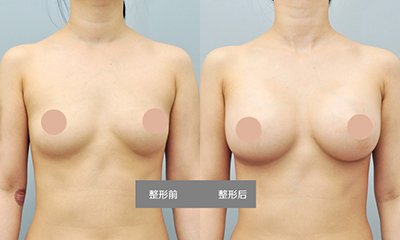 案例图片