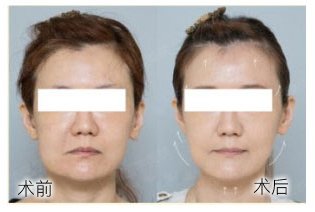 https://img.yiyiaimei.com/Editor/2016-12-23/585d2c0ce2c48.jpg