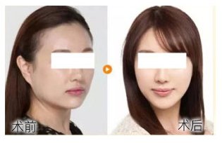 https://img.yiyiaimei.com/Editor/2016-12-23/585d2c0d314d7.jpg
