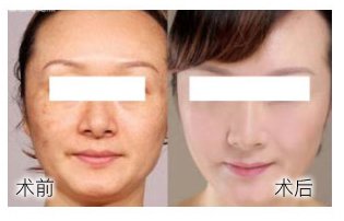 https://img.yiyiaimei.com/Editor/2016-12-23/585d2c0d51780.jpg