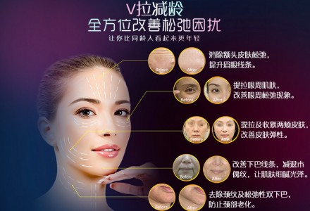 超声刀 补充你的胶原蛋白 让皮肤紧绷起来