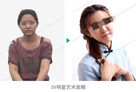 5V明星艺术面雕 精致面庞自然秀出来