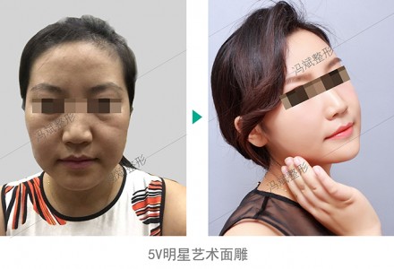 5V明星艺术面雕 精致面庞自然秀出来