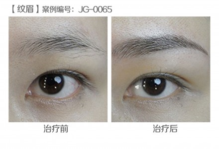 韩式半永久纹眉 塑造精致眉形