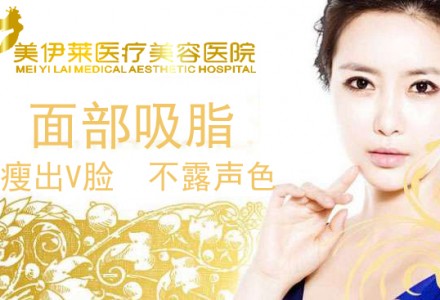 昆明面部吸脂-