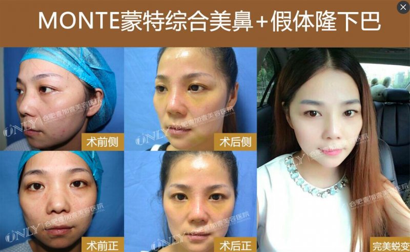 案例图片