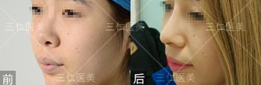 案例图片