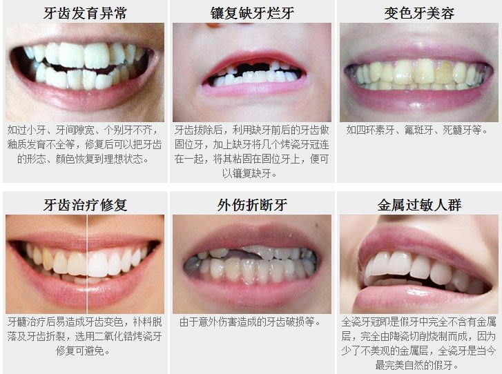 https://img.yiyiaimei.com/mnt/Editor/2017-07-17/596c363f84226.jpg