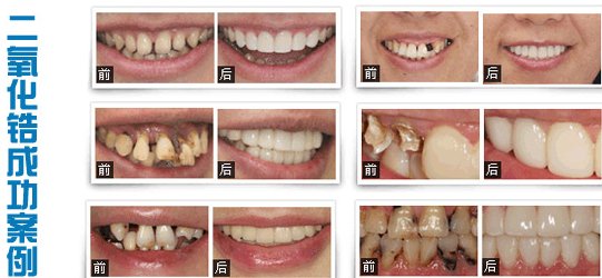 https://img.yiyiaimei.com/mnt/Editor/2017-07-17/596c36432a87e.jpg