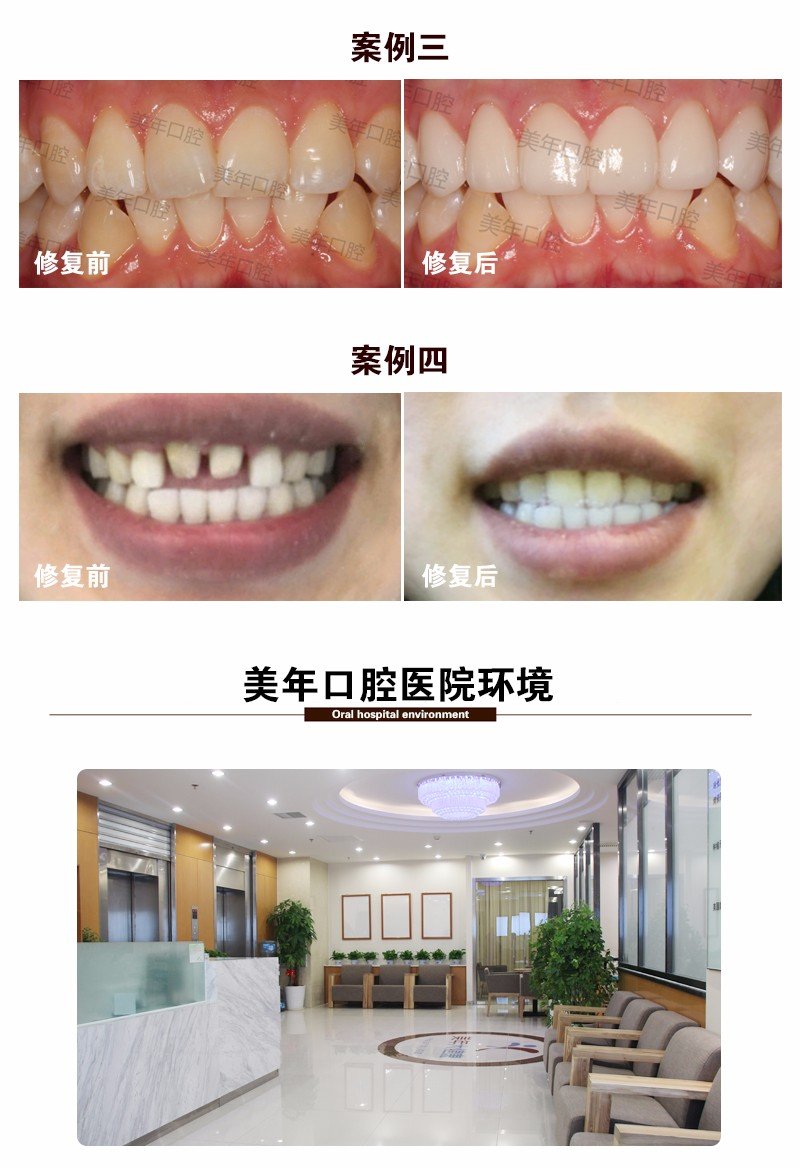 https://img.yiyiaimei.com/mnt/Editor/2017-07-17/596c44192e1c9.jpg
