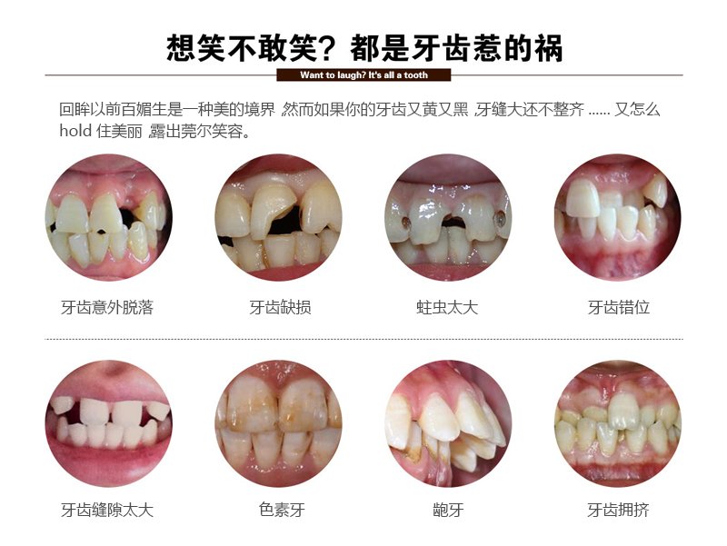 https://img.yiyiaimei.com/mnt/Editor/2017-07-17/596c468f3b2eb.jpg