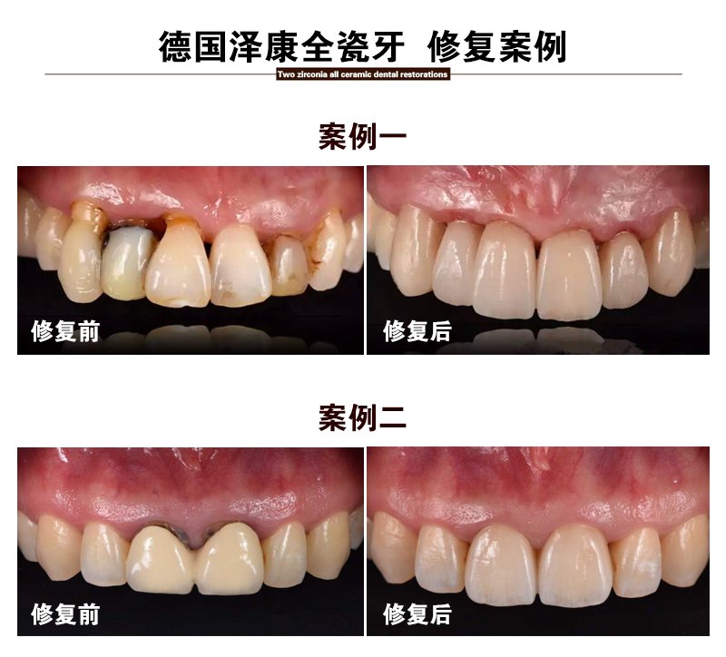 https://img.yiyiaimei.com/mnt/Editor/2017-07-17/596c4690a6e64.jpg