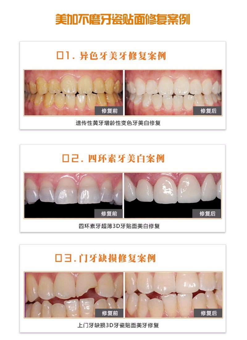 https://img.yiyiaimei.com/mnt/Editor/2017-07-17/596c48fe0cd48.jpg