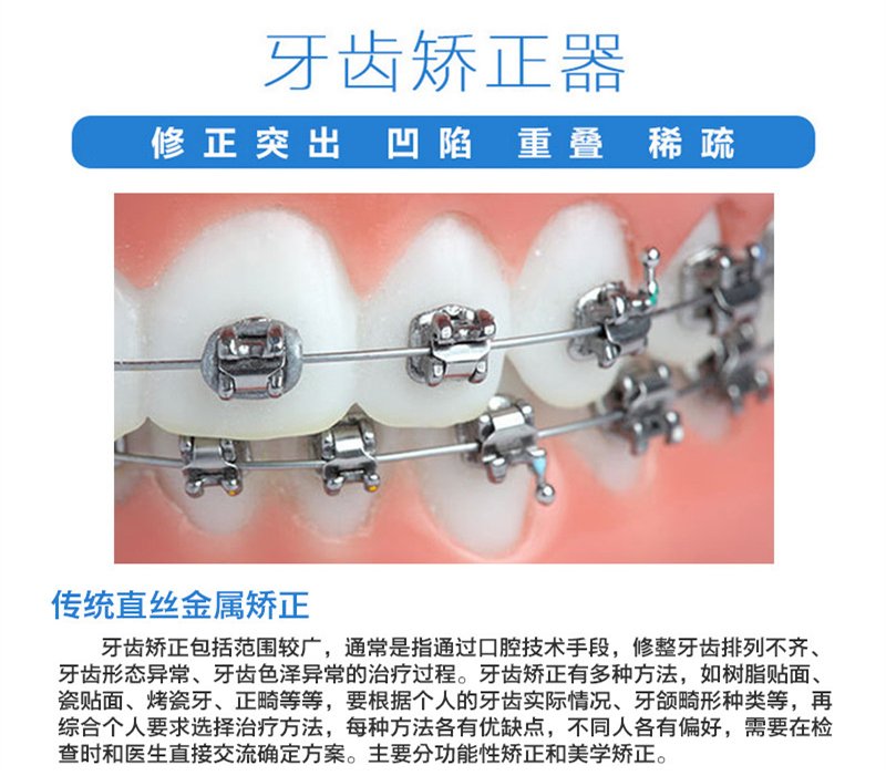 https://img.yiyiaimei.com/mnt/Editor/2017-07-17/596c4a95a73ca.jpg