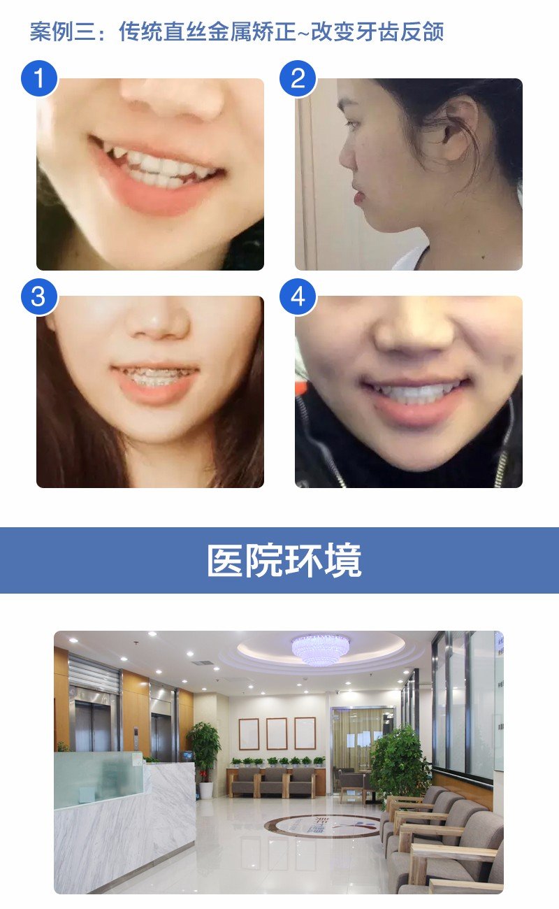 https://img.yiyiaimei.com/mnt/Editor/2017-07-17/596c4a9725a71.jpg