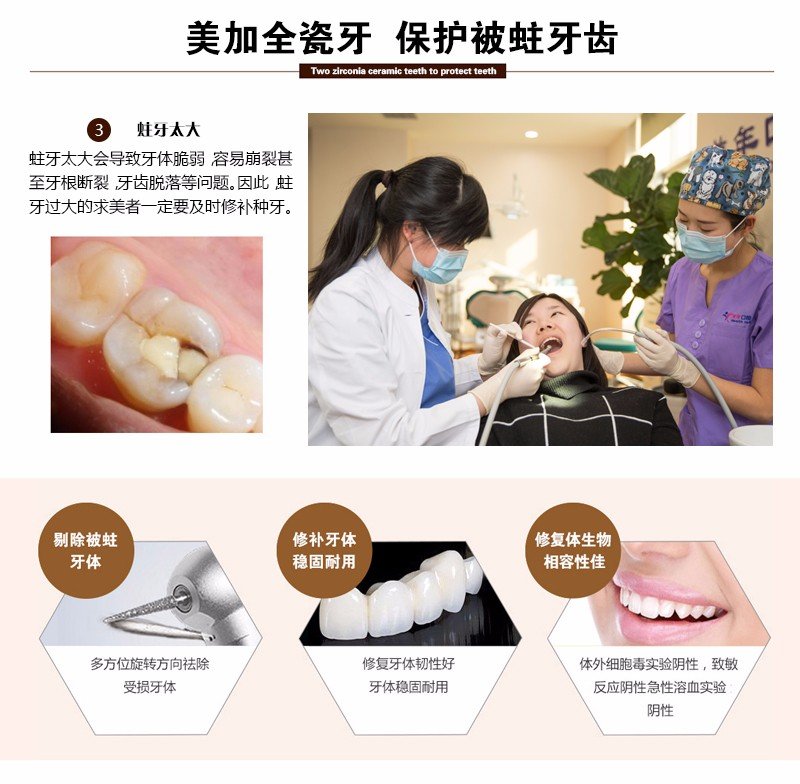 https://img.yiyiaimei.com/mnt/Editor/2017-07-17/596c4c401cabe.jpg