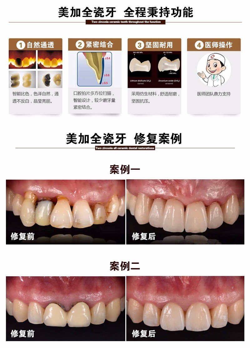 https://img.yiyiaimei.com/mnt/Editor/2017-07-17/596c4c4083c9f.jpg