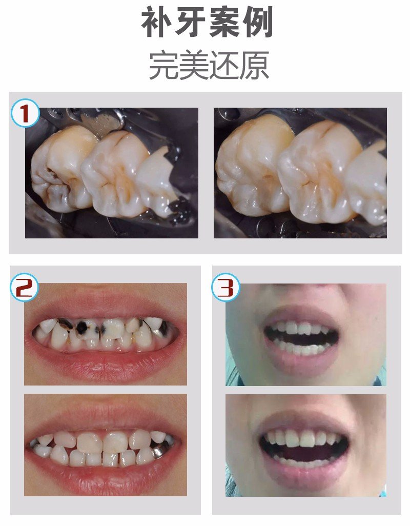https://img.yiyiaimei.com/mnt/Editor/2017-07-17/596c521c8d13b.jpg
