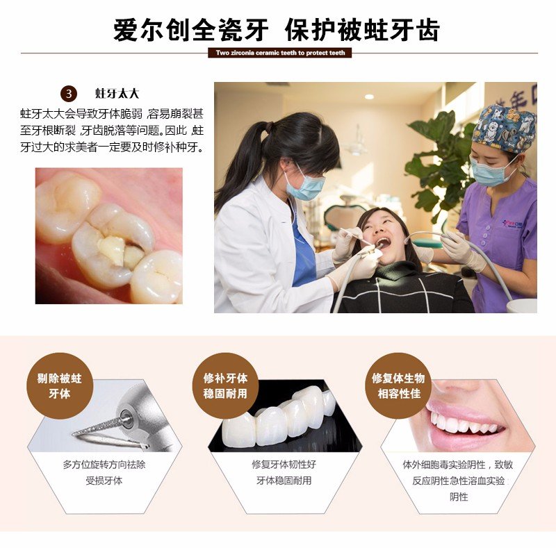 https://img.yiyiaimei.com/mnt/Editor/2017-07-17/596c621b25131.jpg